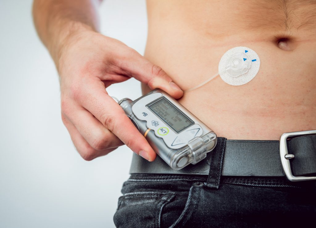 How Do Insulin Pumps Work