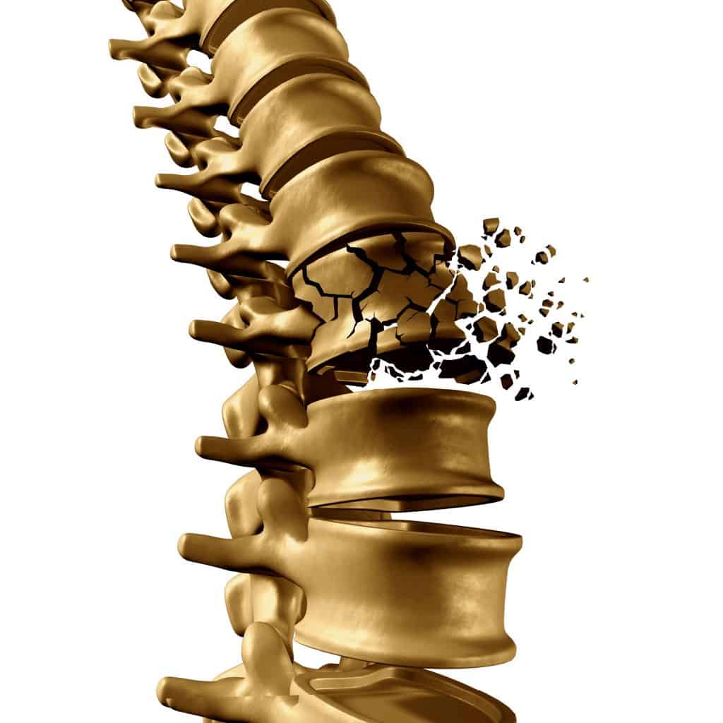 The Link Between Diabetes and Osteoporosis