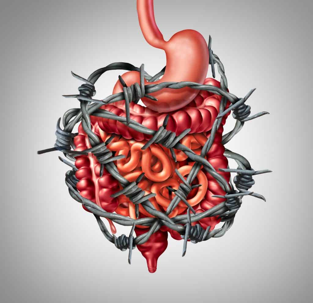 How are IBS and Stress Related