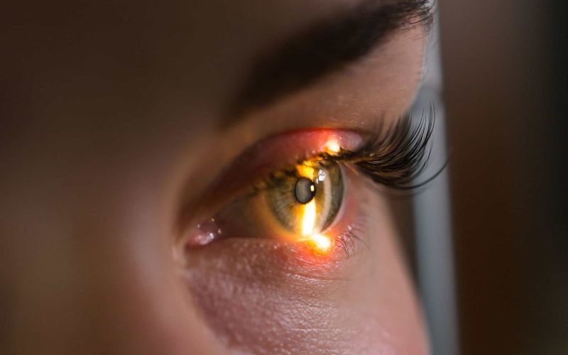 Research and scanning eye, close-up photos, retinal diagnostics in ophthalmology