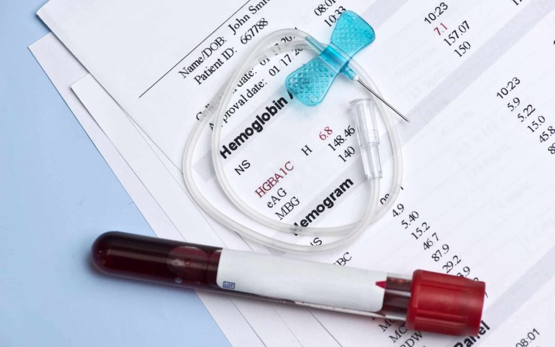 Hematology A1C report with butterfly catheter and blood collection tube.